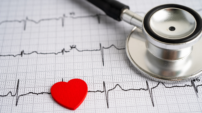 aritmie cardiache cause