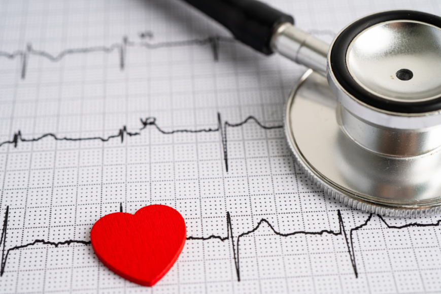 aritmie cardiache cause